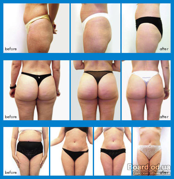 susan cantor md