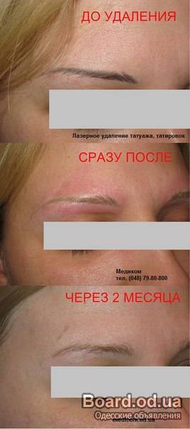 Наращивание ресниц шелковых ресниц. отзывы Наращивание ресниц шелковых ресниц. отзывы